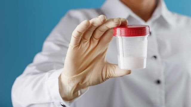 Xét nghiệm tinh dịch đồ bao lâu có kết quả còn phụ thuộc vào các yếu tố như: Thiết bị y tế, chuyên môn của bác sĩ xét nghiệm, chất lượng cơ sở xét nghiệm…