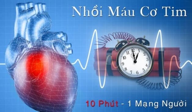 Nhồi máu cơ tim là biến chứng phổ biến nhất của chứng xơ vữa mạch vành, một trong những nguyên nhân hàng đầu gây tử vong và tàn phế,