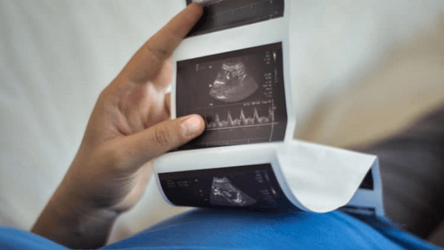 Tìm hiểu nguyên nhân thai không có túi noãn hoàng