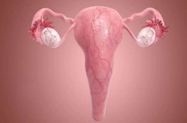 Tắc vòi trứng là hiện tượng xảy ra khi vòi trứng chít hẹp, gây cản trở không cho trứng di chuyển xuống tử cung gặp tinh trùng