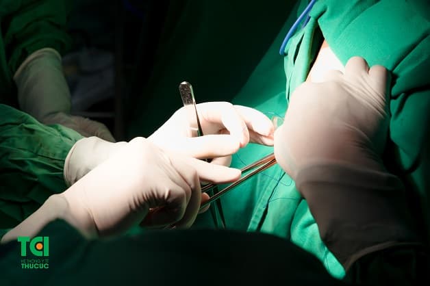 Rò hậu môn phải làm sao - phẫu thuật cắt bỏ