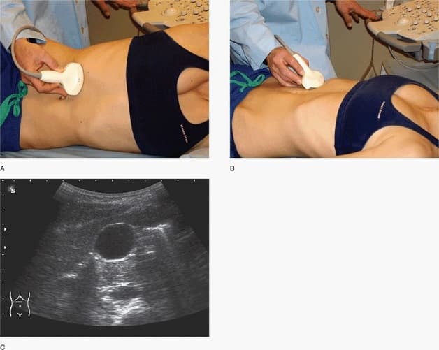 Hình ảnh siêu âm gan mật