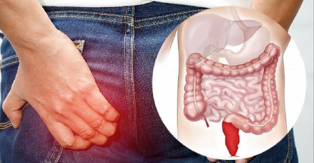 Trực tràng nằm ở đâu và thường gặp những bệnh gì?