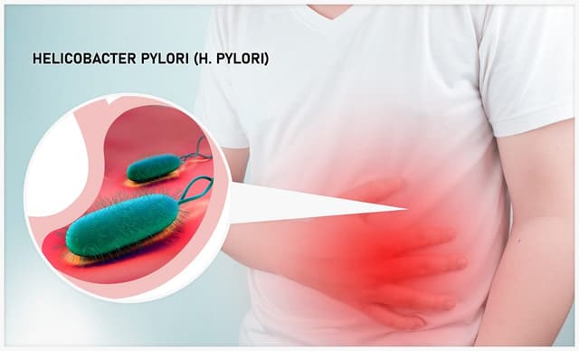 Vi khuẩn HP là gì và nguy hiểm như thế nào?