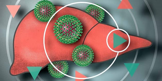 Bệnh viêm gan B mãn tính