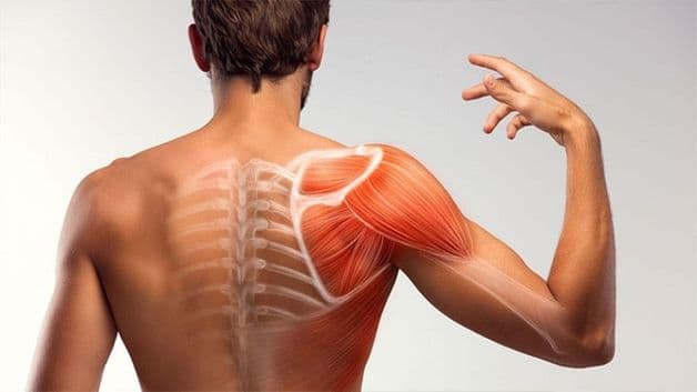 viêm khớp bả vai