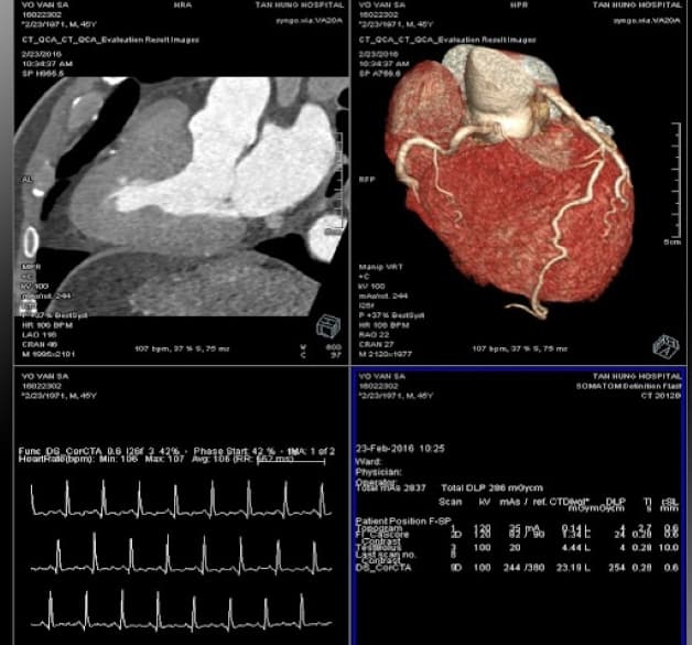 Kết quả hiển thị ngay trên máy vi tính được kết nối với máy chụp