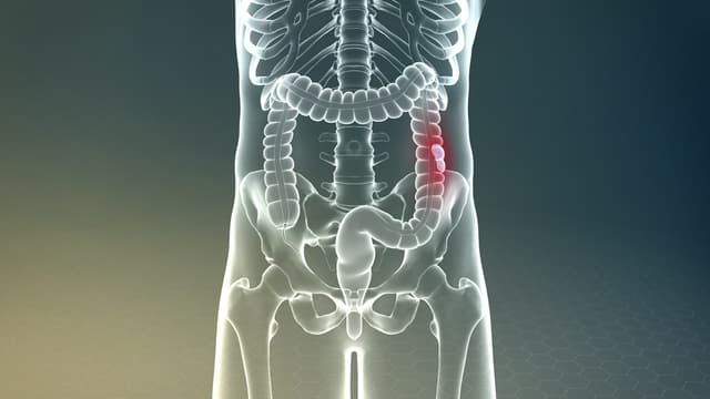 Chụp X quang đại tràng có cản quang tóm gọn nhiều bệnh lý