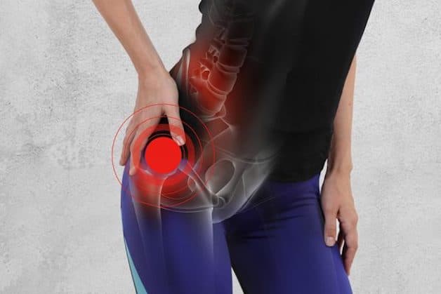 chi phí thay khớp háng bao nhiêu tiền