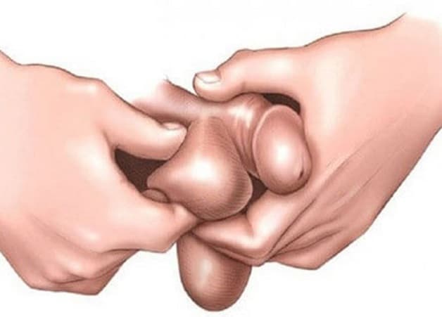 giãn tinh toàn là gì