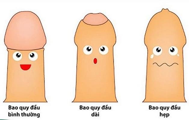 bệnh hẹp bao quy đầu