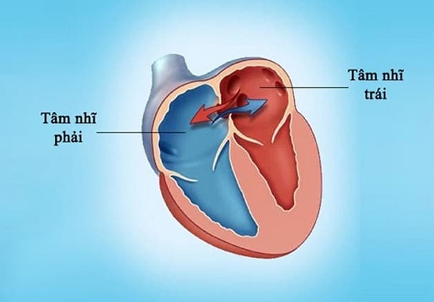 Bệnh thông liên nhĩ có nguy hiểm không tùy thuộc vào số lượng, kích thước lỗ thông và tình trạng sức khỏe của bệnh nhân.