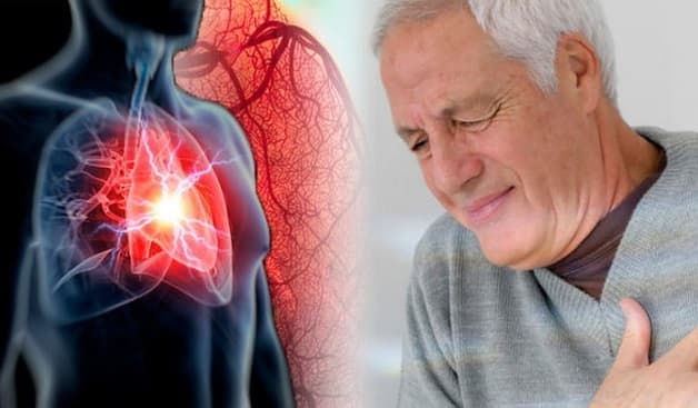 các trường hợp nhồi máu cơ tim sống được bao lâu