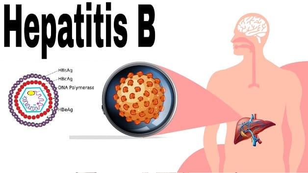 Viêm gan B là gì?