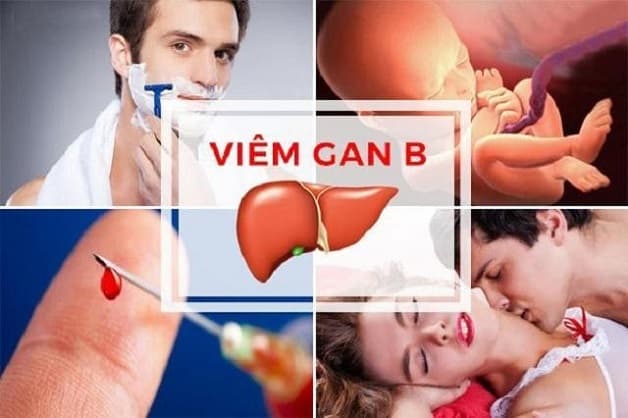 Viêm gan B lây như thế nào?