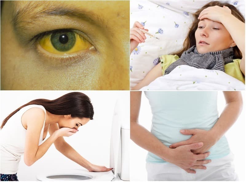 Viêm túi mật triệu chứng thường là đau