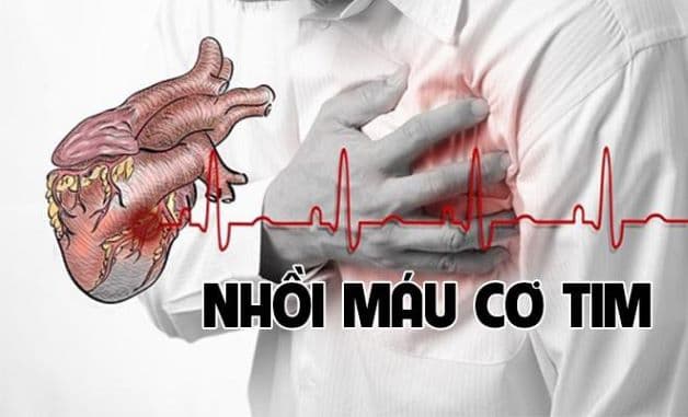 Khi có các triệu chứng cảnh báo hoặc nghi ngờ nhồi máu cơ tim, bệnh nhân cần thăm khám ngay