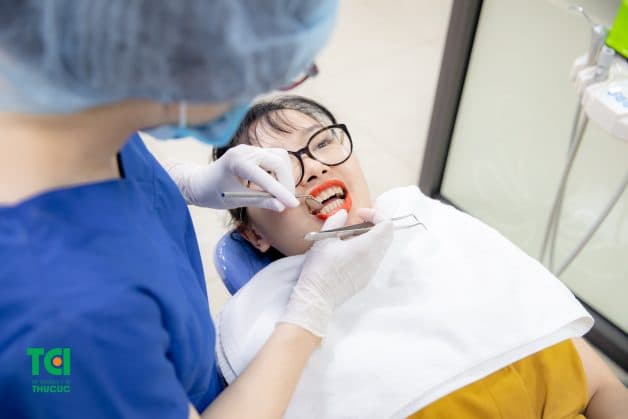 các bước niềng răng hô