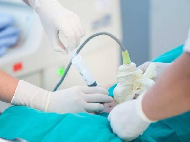 Chọc ối giúp tầm kiểm soát dị tật thai nhi