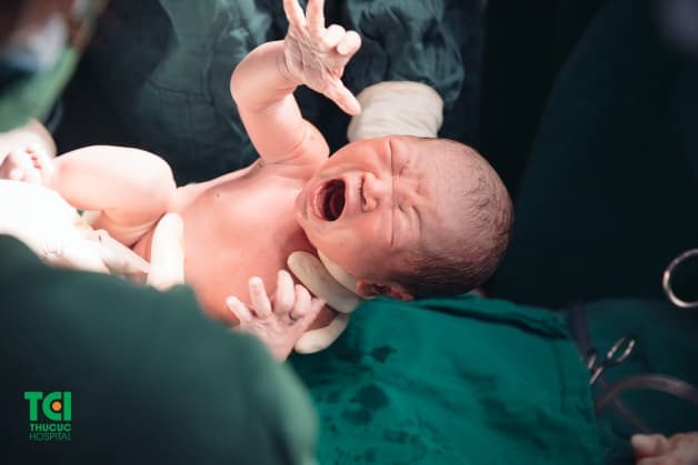 Đẻ thường hay đẻ mổ