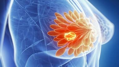 Mổ u xơ vú được thực hiện như thế nào? Có để lại sẹo?