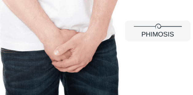 Tình trạng hẹp bao quy đầu là gì