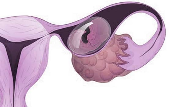 Vòi trứng thông hạn chế là gì