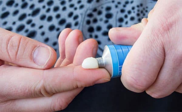 Không tự ý điều trị bệnh trĩ tại nhà