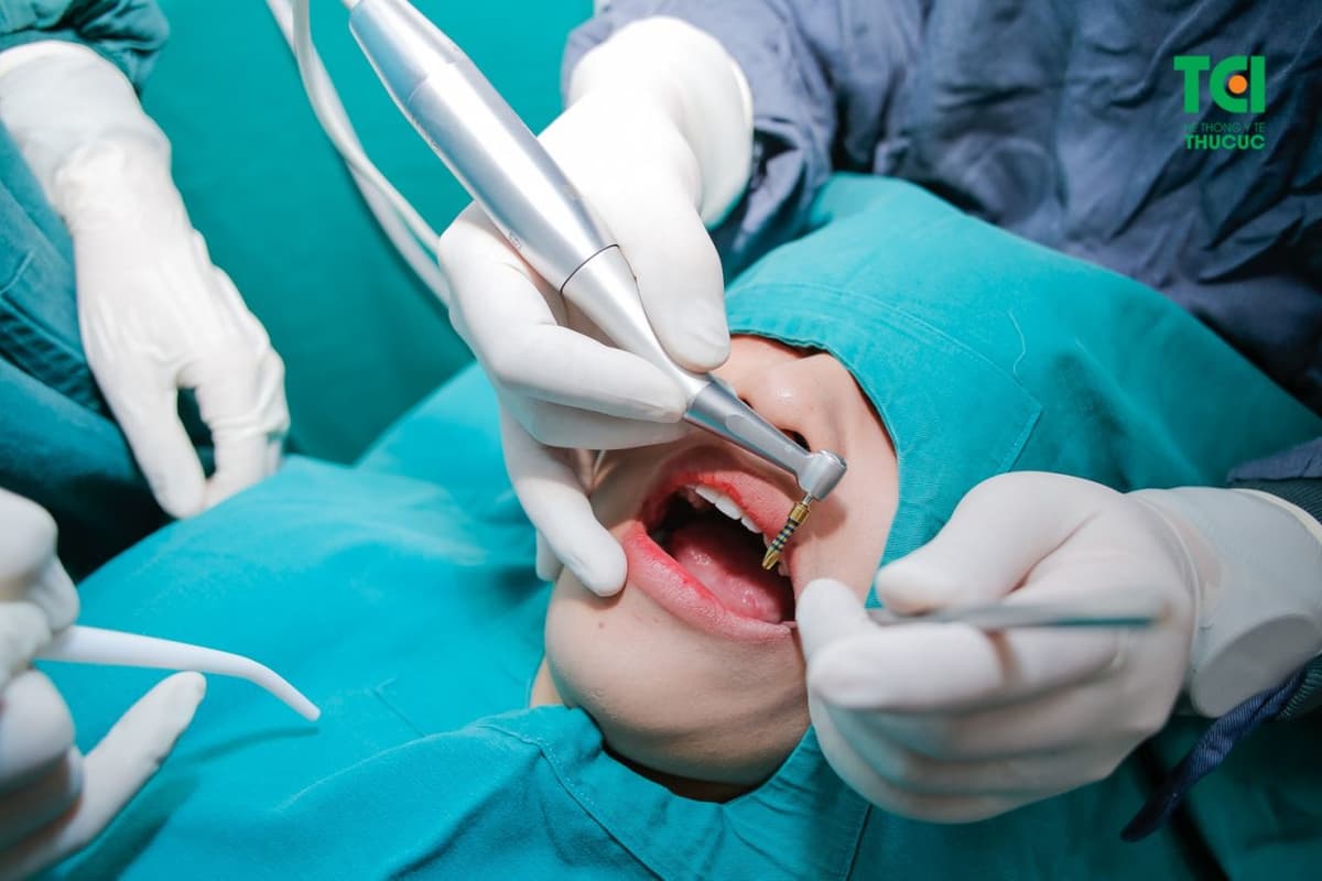 Ưu &amp; nhược điểm của phương pháp trồng răng sứ implant
