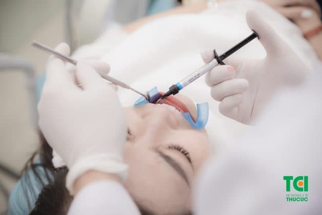 tẩy trắng răng laser là gì