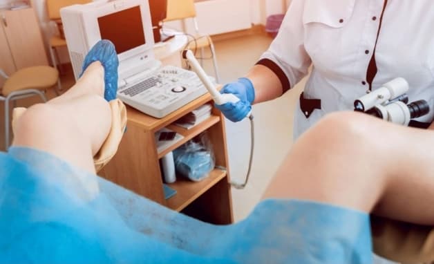 Siêu âm đầu dò âm đạo