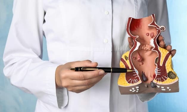 Bệnh trĩ nội và cách điều trị