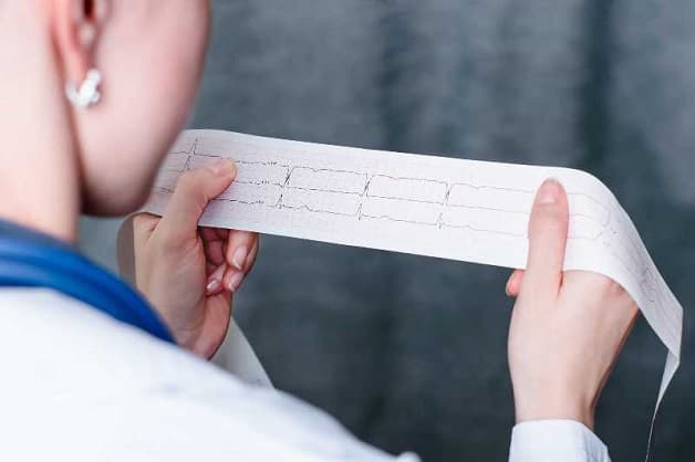 Chẩn đoán bệnh rối loạn nhịp tim ở các trẻ nhỏ