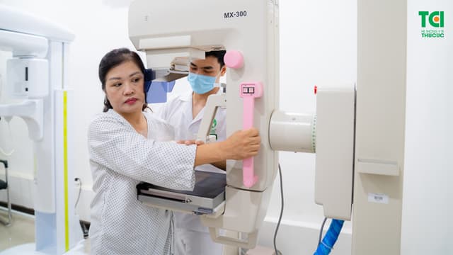 Có nên tầm soát ung thư vú sớm không?