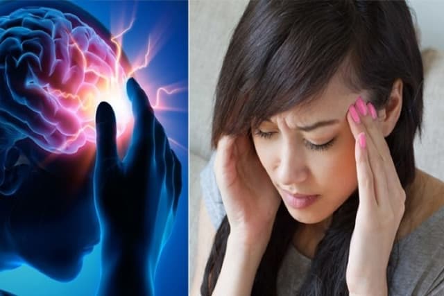 Đột quỵ nhồi máu não ngày càng phổ biến và trẻ hóa