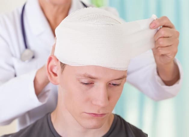 đau đầu do chấn thương sọ não