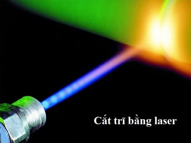 Cắt trĩ sử dụng tia laser có thể điều chỉnh cường độ phù hợp
