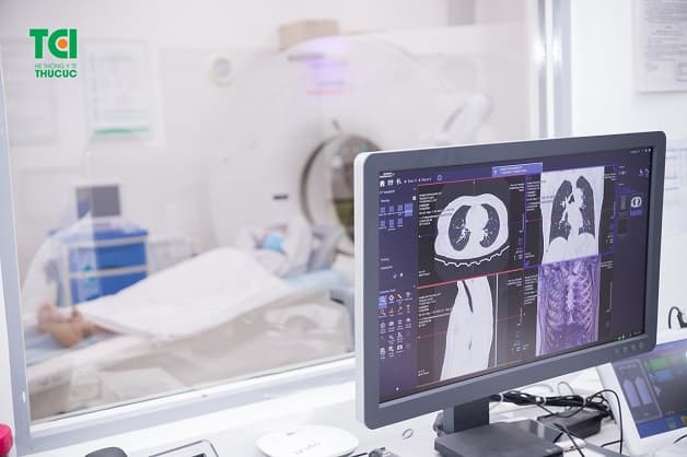 khám bệnh mất ngủ ở đâu đến ngay Thu Cúc TCI