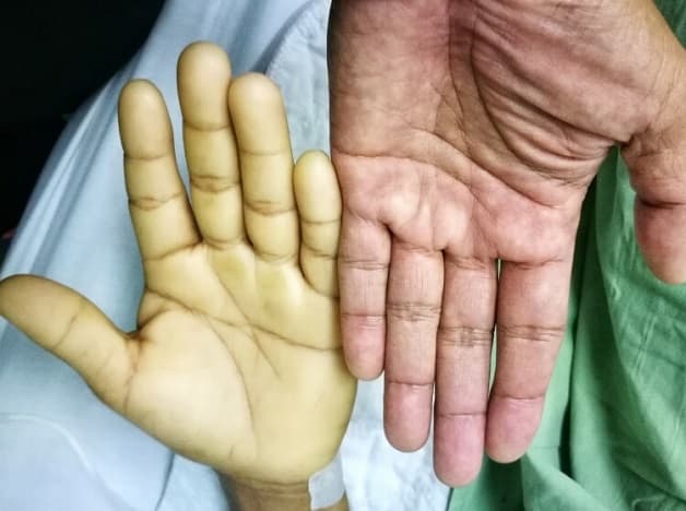 Khám và điều trị ung thư đường mật - dấu hiệu