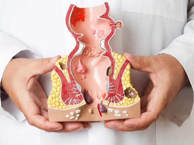 kham-va-dieu-tri-ung-thu-hau-mon-2