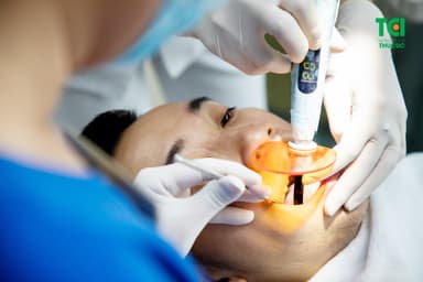 Nhổ răng cấm hàm trên có nguy hiểm không? 