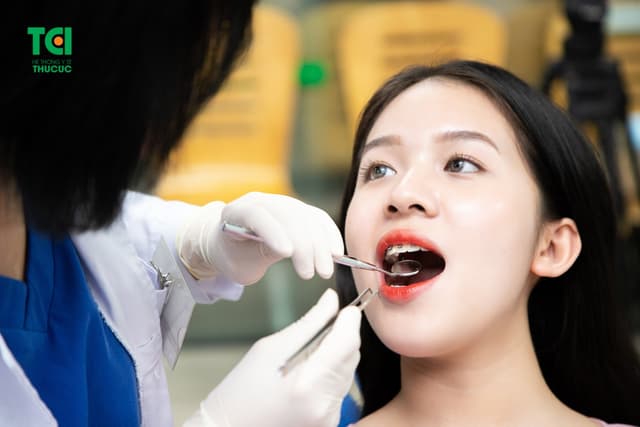 Niềng răng khấp khểnh mất bao lâu?