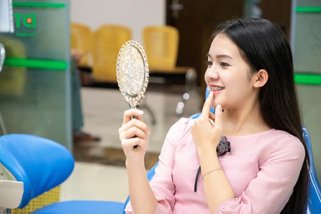 Niềng răng làm thay đổi khuôn mặt hay không?