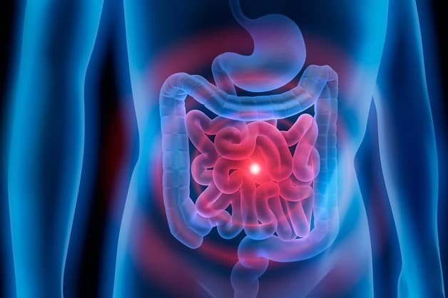 Bệnh xuất huyết tiêu hóa là gì?