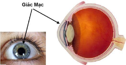 tật khúc xạ về mắt chủ yếu do võng mạc gây ra