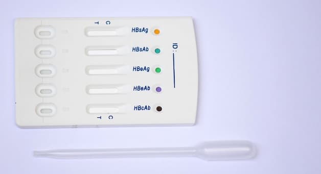 Xét nghiệm HBsAb định lượng