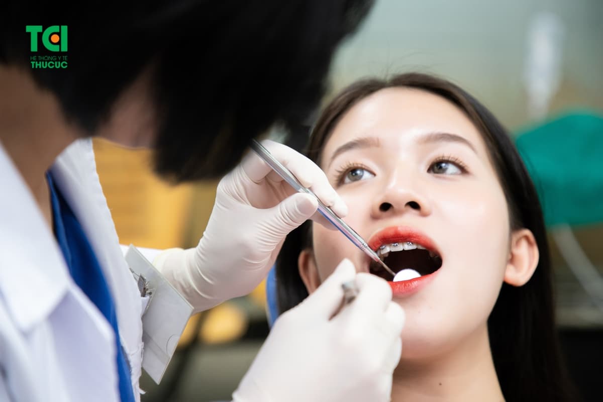 Niềng răng cố định và những điều cần biết
