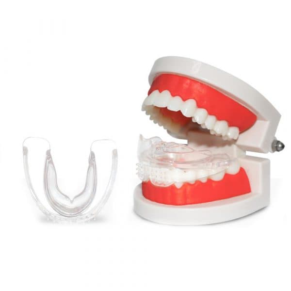 Niềng răng silicon là hoạt động tiền chỉnh nha sử dụng khí cụ niềng được làm bằng chất liệu silicon 