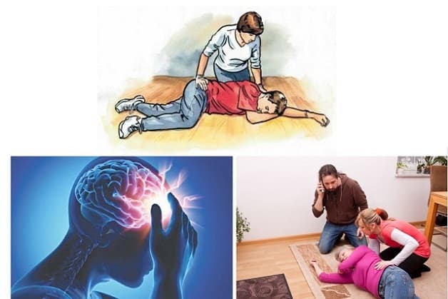 xử trí và phòng ngừa đột quỵ