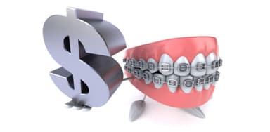 Chi phí niềng răng hô tại nha khoa có cao không?